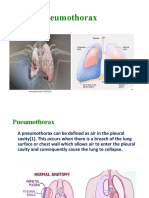 Pneumothorax-WPS Office