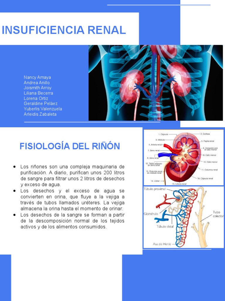 Ira Irc | PDF | Hemodiálisis | Enfermedad renal crónica