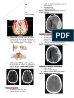 Fraturas de crânio e lesões cerebrais: sinais e tratamento