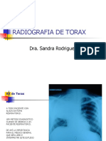 RADIOGRAFIA DE TORAX Clase