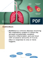 Asthma