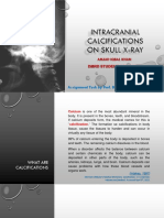Aik 70084398 - Intracranial Calcifications On Skull X-Ray PDF