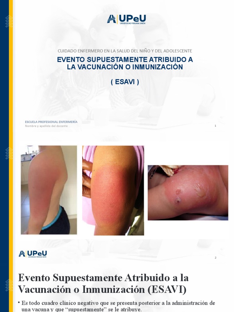4 Esavi | PDF