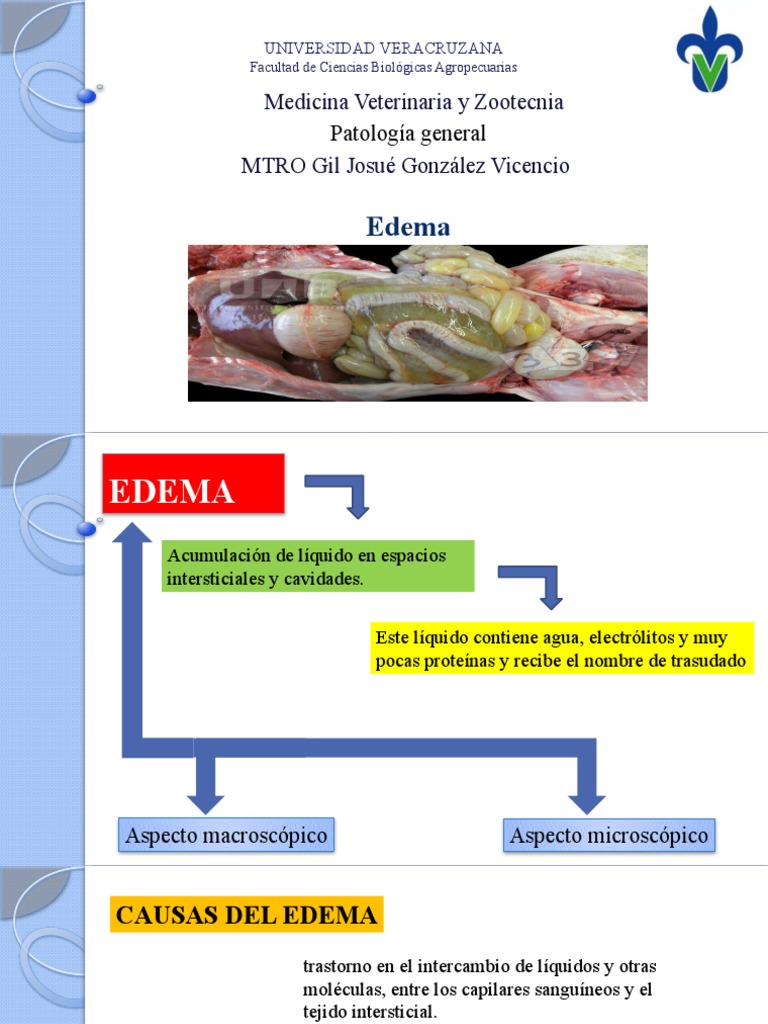 Edema | PDF