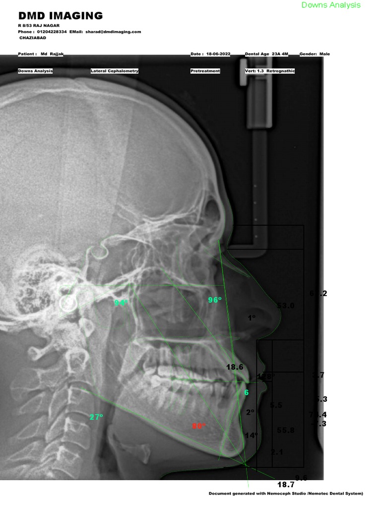 Dental Cephalometric Analysis | PDF