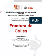 Fractura de Colles