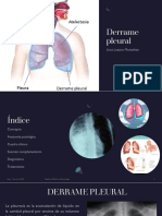 Derrame Pleural PDF