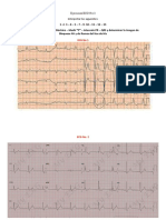 Tarea 3 y 4 ECG