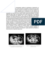 Caso clínico mujer carcinoma renal feocromocitoma