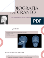 Radiografía de cráneo: Guía completa