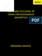 2.4 Anatomía Seccional de Tórax Por Resonancia Magnetica PDF