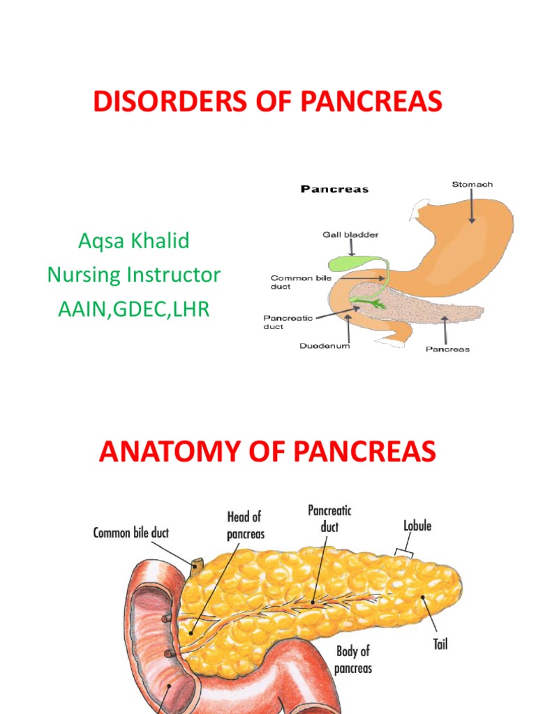 Disorders of Pancreas | PDF