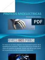 Protesis Mioelectricas