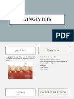Gingivitis PREVENTIVA