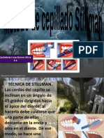 Tecnica de Cepillada Stillman