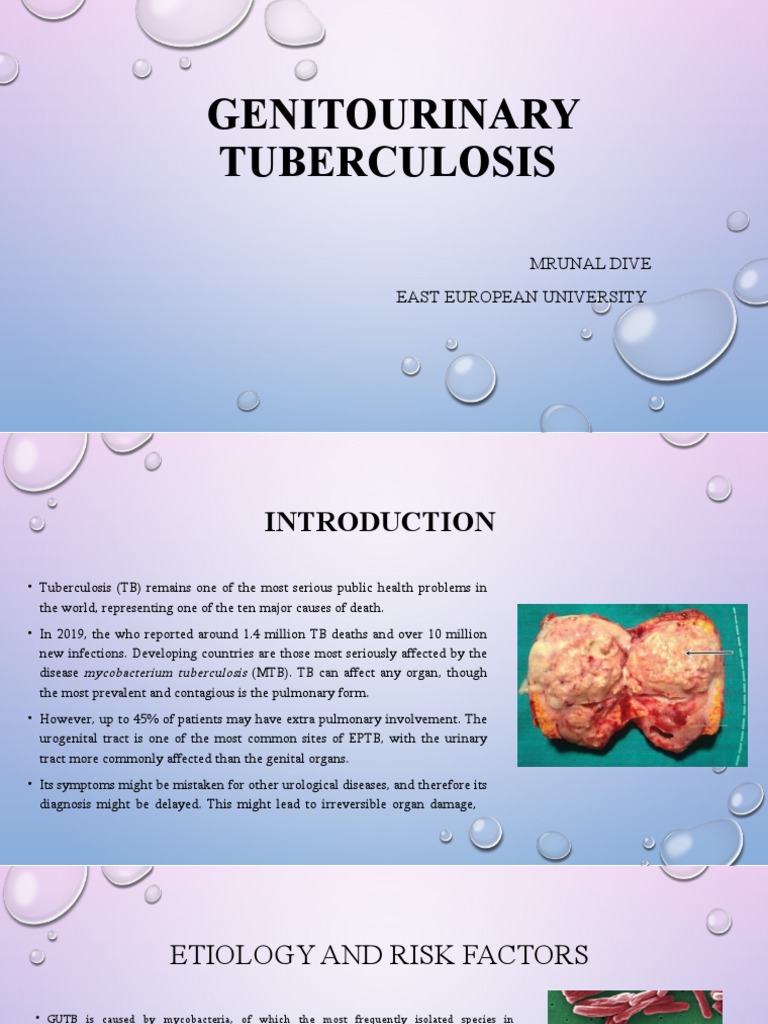 Genitourinary Tuberculosis PDF Tuberculosis Urinary Bladder
