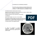 Caso Clinico Adicional Nº2 Ecv Hemorragico Cerebeloso