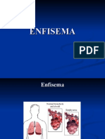 ENFISEMA