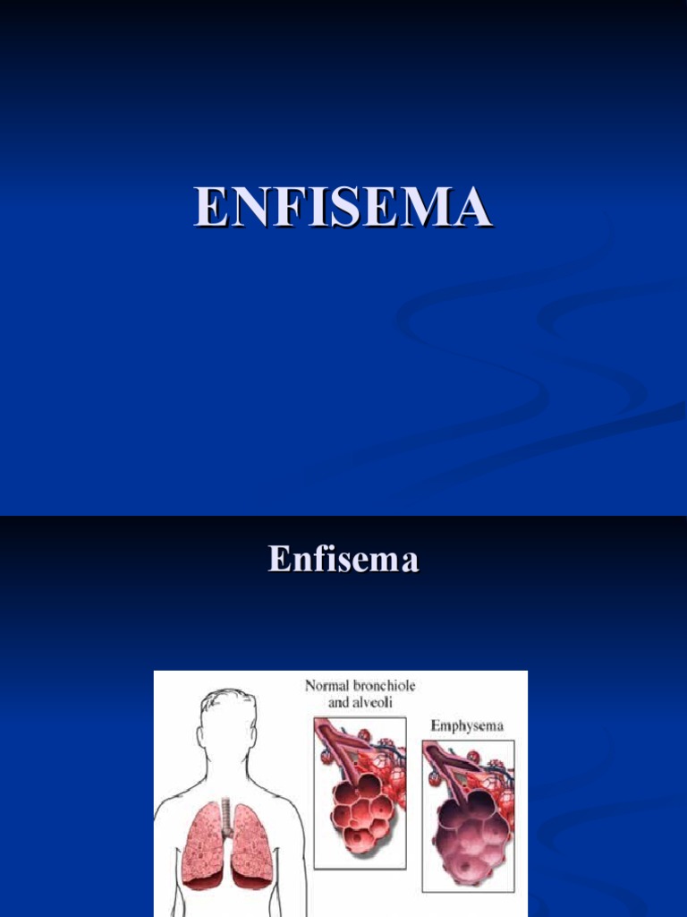 ENFISEMA PDF