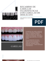 Recambio de Carillas Feldespáticas Con Carillas de Disilicato