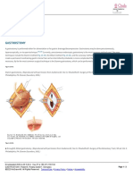 GASTROSTOMY