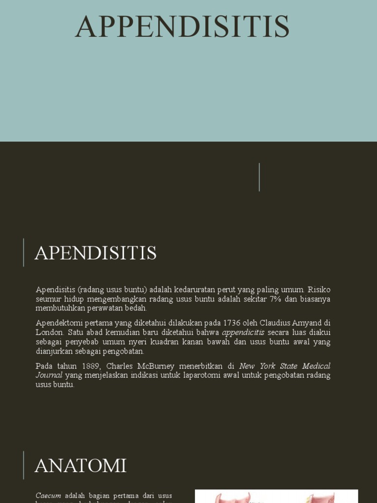 Penanganan Apendisitis Akut | PDF