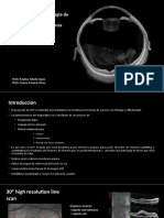 Interpretación y Terminología de OCT 2