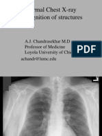 Normal Chest X-Ray A.J. Chandrasekhar M.D