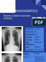 Caso de Éxito PDF