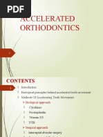 Accelerated Orthodontics