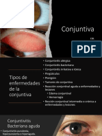 Enfermedades de Conjuntiva 2023