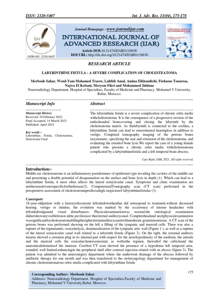 Labyrinthine Fistula A Severe Complication of Cholesteatoma PDF