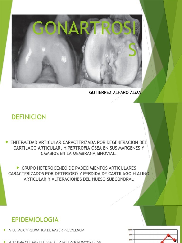 GONARTROSIS | PDF