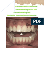 División anatomica de la encía.