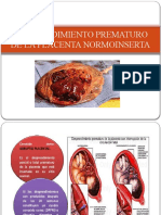 Desprendimiento Prematuro de La Placenta Normoinserta