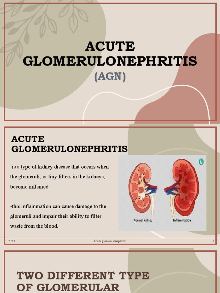 Acute Glomerulonephritis Overview | PDF