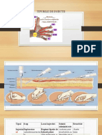 Tipuri de Injectii