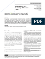 Fulminant Susac Syndrome-A Rare Cause of Coma: The History of The Fatal Course in A Young Man