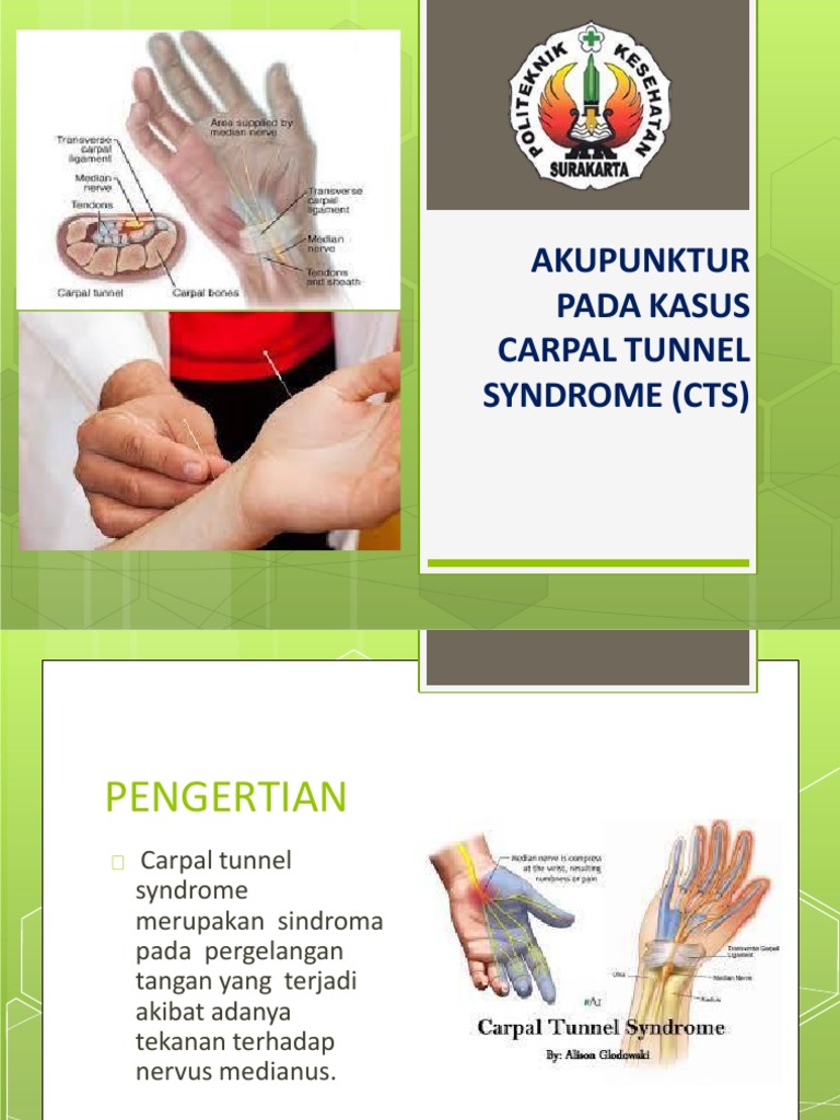 AKUPUNKTUR PADA KASUS CTS Fix PDF | PDF