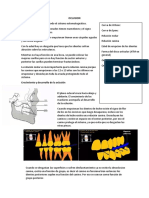 Oclusion PDF