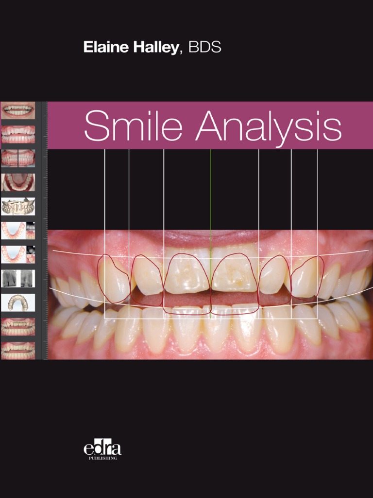 smile-analysis-pdf-pdf-dentistry-physical-attractiveness