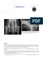 Capital Femoral Physeal Dysplasia PDF