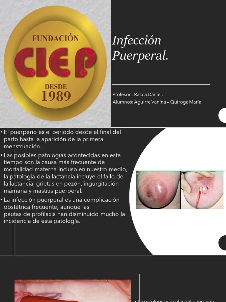 Infeccion Puerperal | PDF | Parto | Periodo posparto