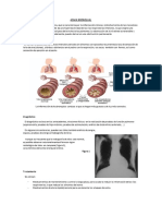 Asma Bronquial