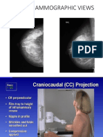 Breast Diseases