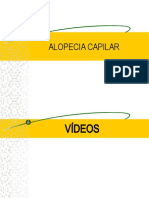 Alopecia Capilar