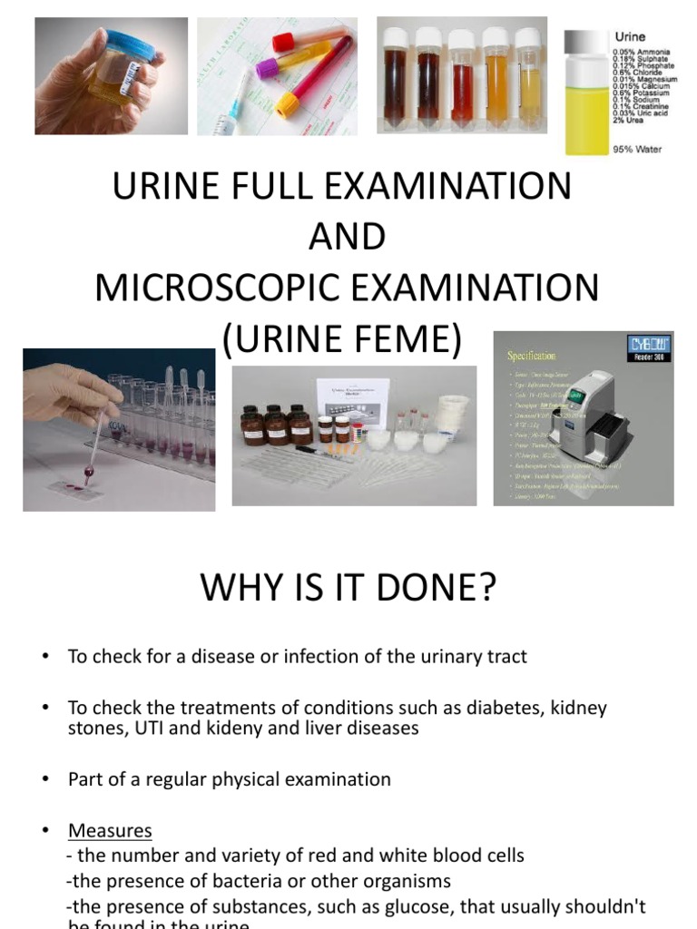 a-comprehensive-guide-to-urine-full-examination-and-microscopic