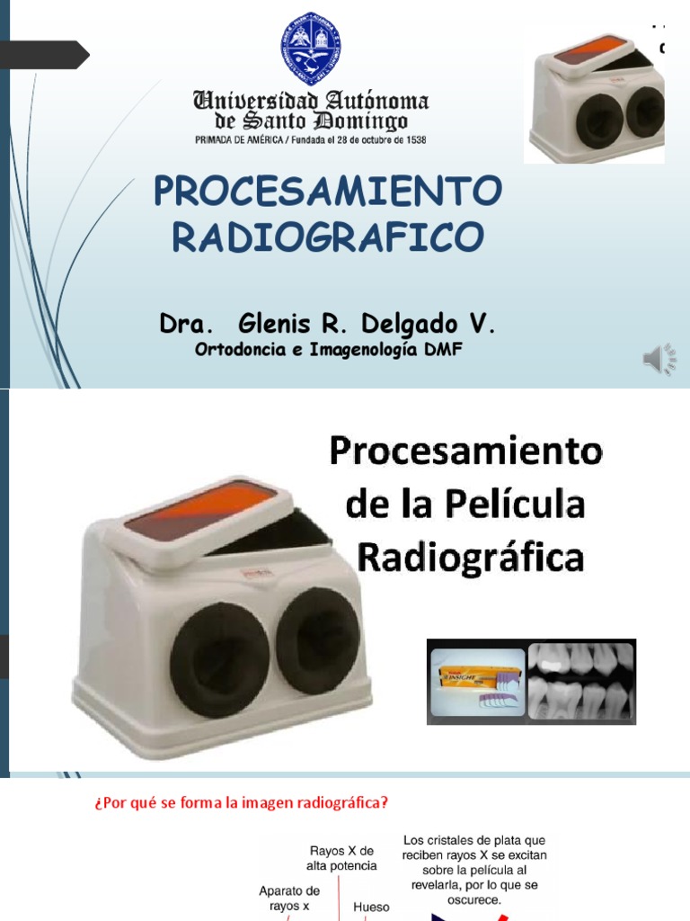 tarea-iv-procesamiento-radiografico-pdf-rayo-x-ligero