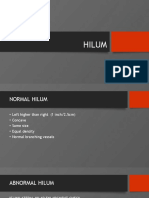 Chest X Ray Differentials