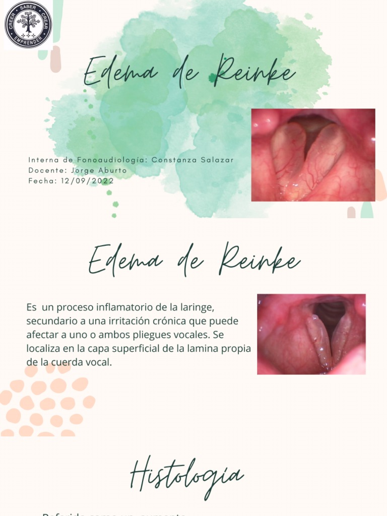 Presentación Edema Reinke PDF